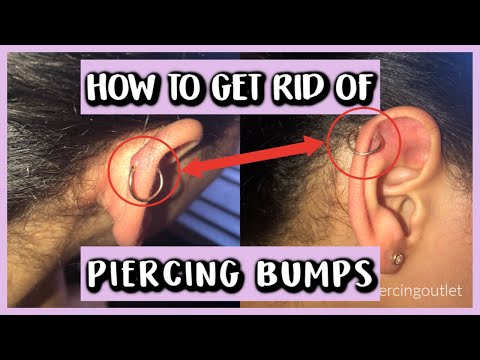 HOW TO GET RID OF PIERCING BUMPS